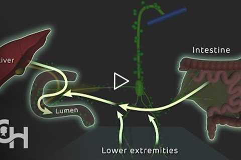 Lymphatic Leakage in PLE