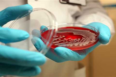 Superbugs could trigger health crisis worse than Covid, experts warn