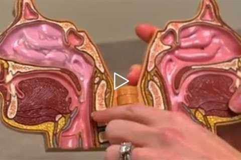 Vocal Fold Paralysis with Otolaryngologist Dr. Lindsey Arviso