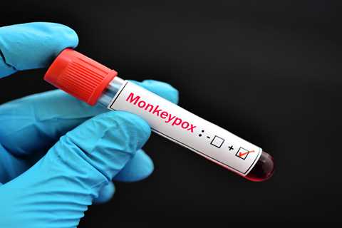 Biden administration proposes changing how monkeypox vaccine is administered ⋆