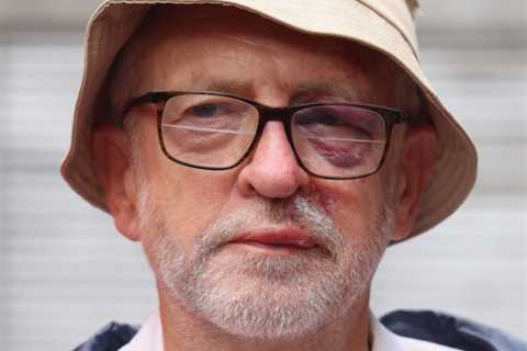 Jeremy Corbyn sports painful black eye and swollen lip after tripping over tree root while on a run