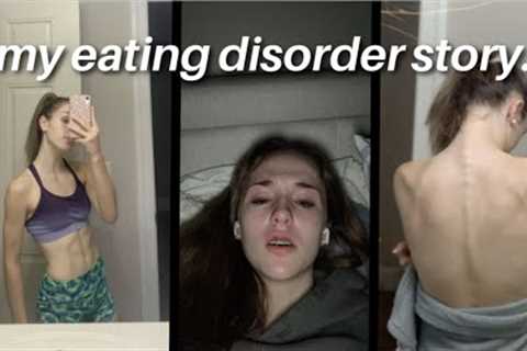 my eating disorder story. // tw: graphic