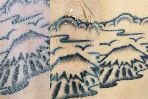 after tattoo lotion | Tatoo Cream