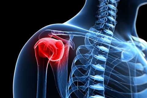 Revision rotator cuff repair associated with return-to-work barriers