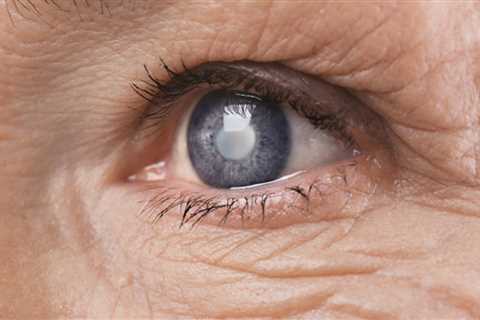 Polygenic risk score linked with higher risk for POAG in patients with ocular hypertension