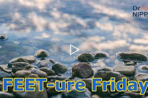 FEET-ure Friday | Fungal Toenails and Severe Athlete's Foot #fungalinfections  #athletesfoot