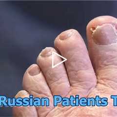 Two Russian Patients Today #foothealth #russian