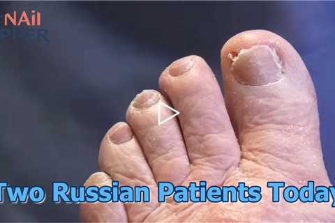 Two Russian Patients Today #foothealth #russian