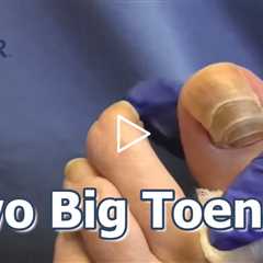 Two Big Toenails #Toenails #foothealth #podiatrycare