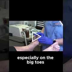 Why Regular Toenail Care Is Key to Comfort and Confidence! #ToenailCare #FootHealth #PodiatryTips
