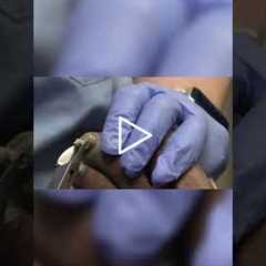 Transitioning to Diabetic Socks A Necessary Step