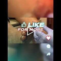 Taking Care of Feet Everyday Practices and Tips