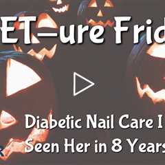 FEET-ure Friday | Really Thick Nails and a 8-year hiatus #thicktoenails