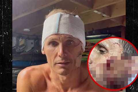 Jamie Mitchell’s Gruesome Wipeout Cuts: A Surfer’s Tale