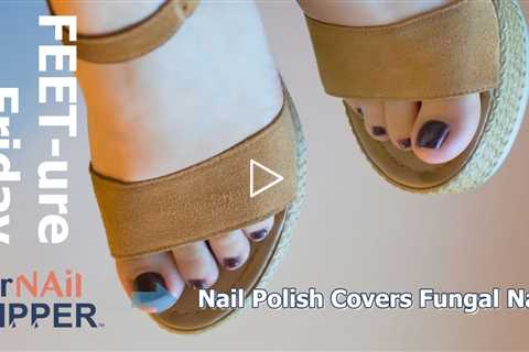 FEET-ure Friday | Nail Polish Covers Fungal Nails