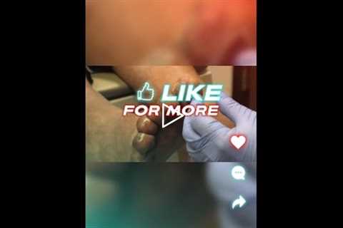 Taking Care of Feet Everyday Practices and Tips