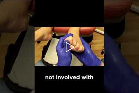 How Cutting Your Shoe Fabric Can Relieve Toe