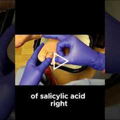 Why Medicated Corn Pads Can Make Foot Pain Worse