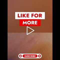 Understanding Blunt Excision Technique! 🩺 #WartRemoval #podiatry  #medicalprocedures  #dermatology