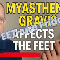 FEET-ure Friday | Living With Myasthenia Gravis: How MG Affects Balance, Fatigue & Foot Care
