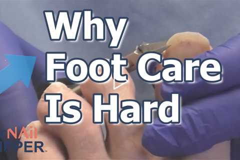 Myasthenia Gravis and the Feet: A Patient Explains What Daily Life Is Really Like #myastheniagravis