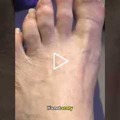 Instant Relief After a Long-Overdue Pedicure 👣 This Tool Has More Power! 😄Nail Trim - Dr Nail..