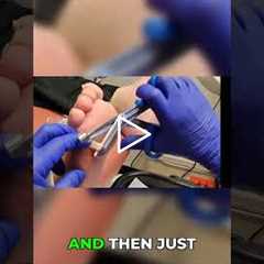 How to Properly Dress a Wound After Showering 💧🩹