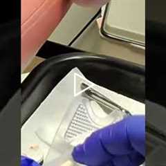 Daily Wound Care Routine That Speeds Healing (Doctor-Approved Tips)