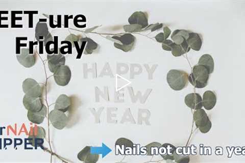 FEET-ure Friday | Nails not cut in a year!