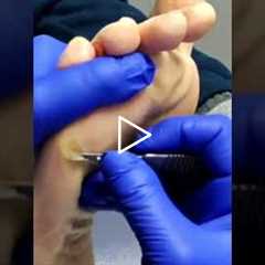 How to Choose the Right Foot Care Products (Doctor-Approved Tips)