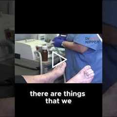 Simple Hacks to Manage Hammer Toe