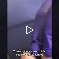 Are Long Second Toes Genetic? What It Means for Your Nails