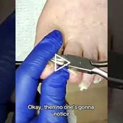 The Importance of Regular Skin Checks