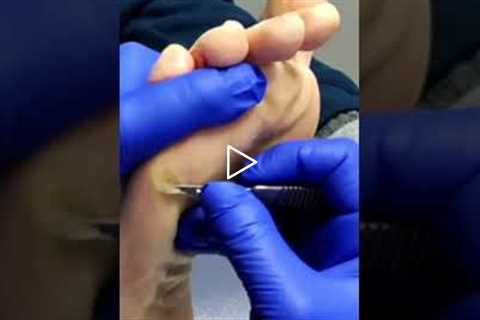 How to Choose the Right Foot Care Products (Doctor-Approved Tips)