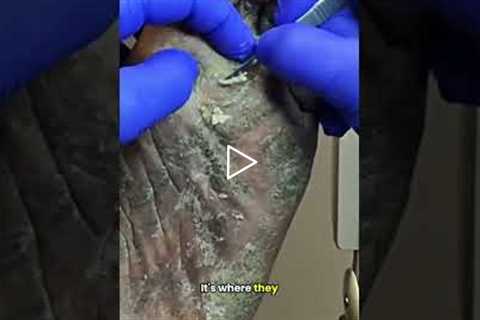 What’s Causing Shooting Foot Pain? ⚡🦶