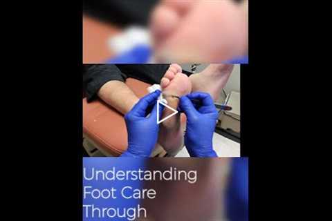 Understanding Foot Care Through Wound Management 👟