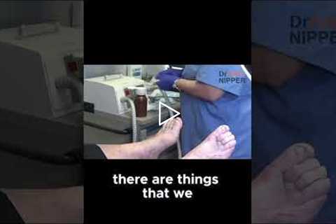 Simple Hacks to Manage Hammer Toe