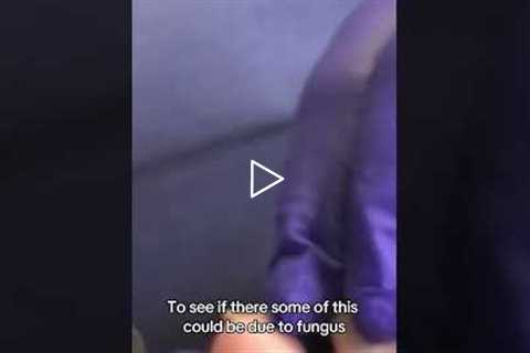 Are Long Second Toes Genetic? What It Means for Your Nails