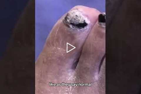 More Than Foot Care: Conversations in the Chair