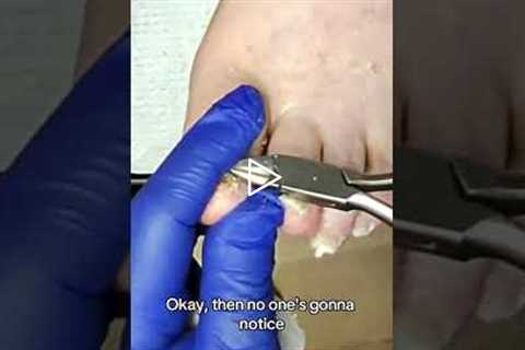 The Importance of Regular Skin Checks