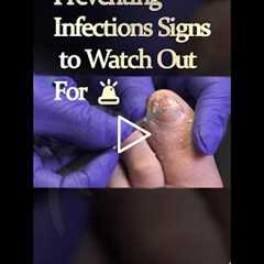 Preventing Infections Signs to Watch Out For 🚨