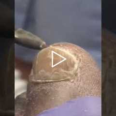 Foot Care and Insurance Coverage | Do You Take Insurance? (What Patients Always Ask) 👀