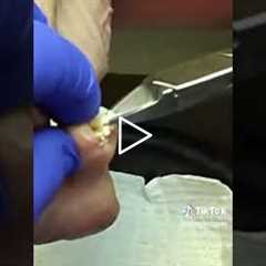 This Is Why Your Toenails Are Always Pinched