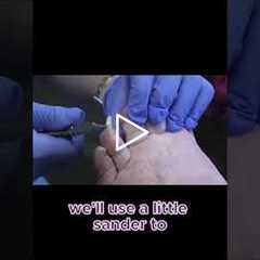 Trimming Thick Nails Like You've Never Seen #satisfying #asmr