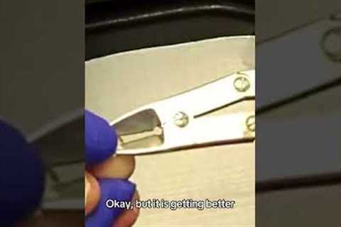 Why Broken Bones Heal Slower As We Age 🦴 (Real Patient Story)