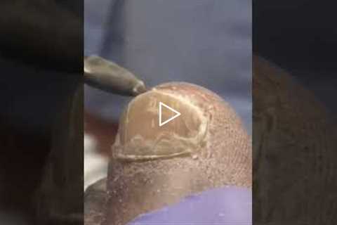 Foot Care and Insurance Coverage | Do You Take Insurance? (What Patients Always Ask) 👀