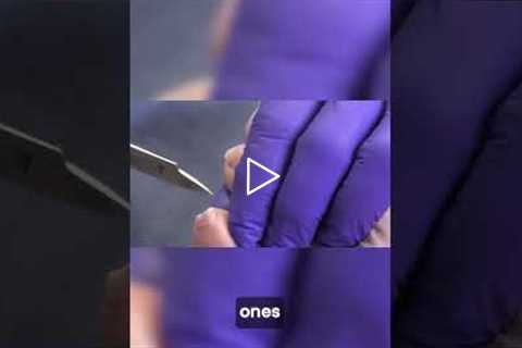 Birthday Wings & Toenail Care 🍗 | You’ll Love This Patient!