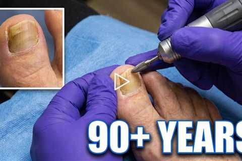 He’s Been Doing His Own Toenails for 90+ Years 😳 | No Talking, Just Pure Nail Care ASMR