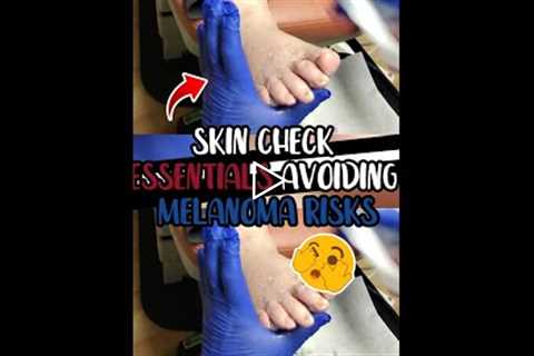 Skin Check Essentials Avoiding Melanoma Risks