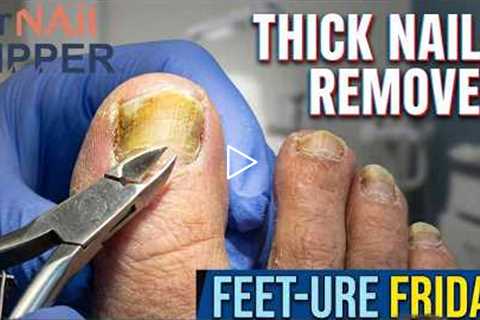 FEET-ure Friday | Gentleman with Long, Thick Toenails